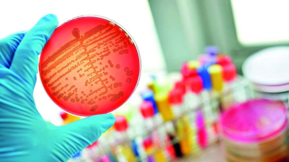 Bacterial culture on nutrient medium